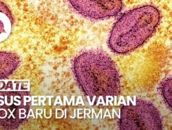 Video: Jerman Identifikasi Tindak Kejahatan Pertama Varian Mpox Mutakhir