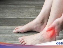 4 Air Rebusan Daun Untuk Menurunkan Asam Urat, Salah Satunya Sirsak