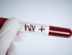 Begini Ciri-ciri HIV yang Muncul Di Kemaluan Pria