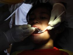 Kemenkes Ungkap Separuh Warga Indonesia Mengeluh Sakit Gigi, Tapi Ogah Periksa