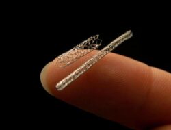 Apakah Semua Pasien Sakit Jantung Harus Pasang Ring? Begini Penjelasan Praktisi Medis