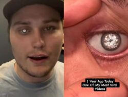 Cerita Ke Balik Viral Pria Punya Mata Palsu Berhiaskan Berlian Mewah