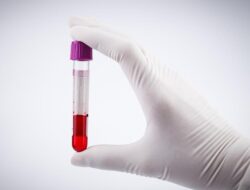 Terungkap Golongan Darah yang Lebih Berisiko Kena Stroke, Ini Alasannya