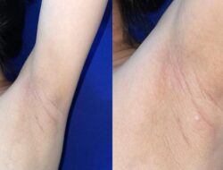 Nggak Normal Tapi Banyak Terjadi