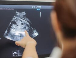 USG Tiap Bulan Bisa Bahayakan Janin, Benarkah? Begini Penjelasan Obgyn