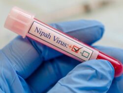 Praktisi Medis Ungkap yang Terjadi Ke Otak Di Terinfeksi Patogen Nipah, Bisa Fatal