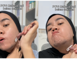 Viral Gadis 23 Tahun Ke Madura Tumbuh Brewok, Ternyata Idap Kemakmuran Ini