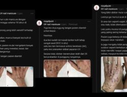 Wanita 52 Tahun Kena Kanker, Benarkah gegara Sering Manicure UV Nail Lamp?
